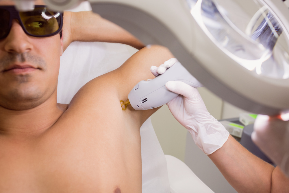 הסרת שיער בלייזר ללא כאבים